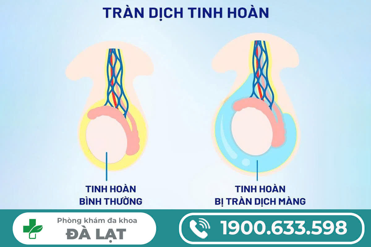 Hình ảnh minh họa